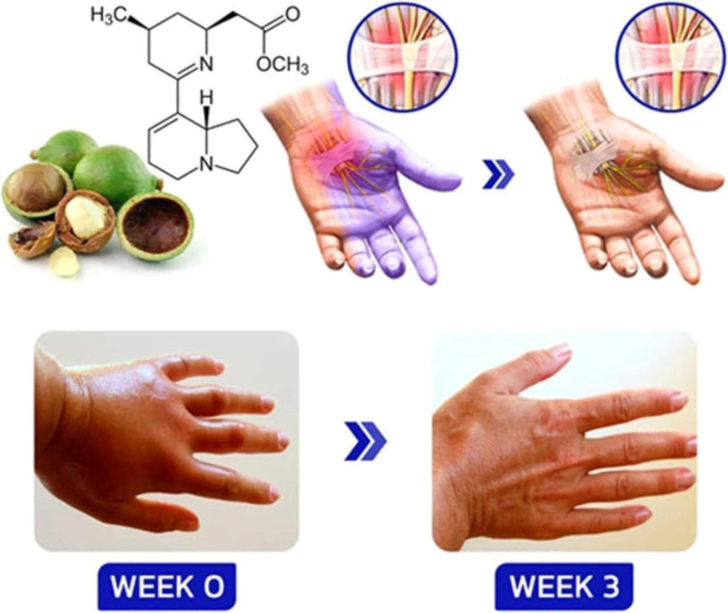 Numbfix Spray for Hand & Foot Discomfort