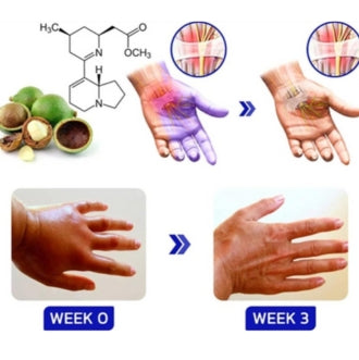 Numbfix Spray for Hand & Foot Discomfort